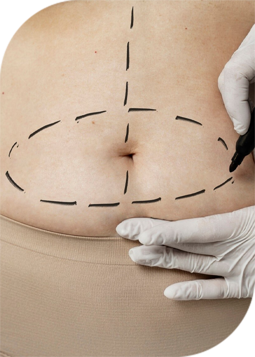 Post Op Services
